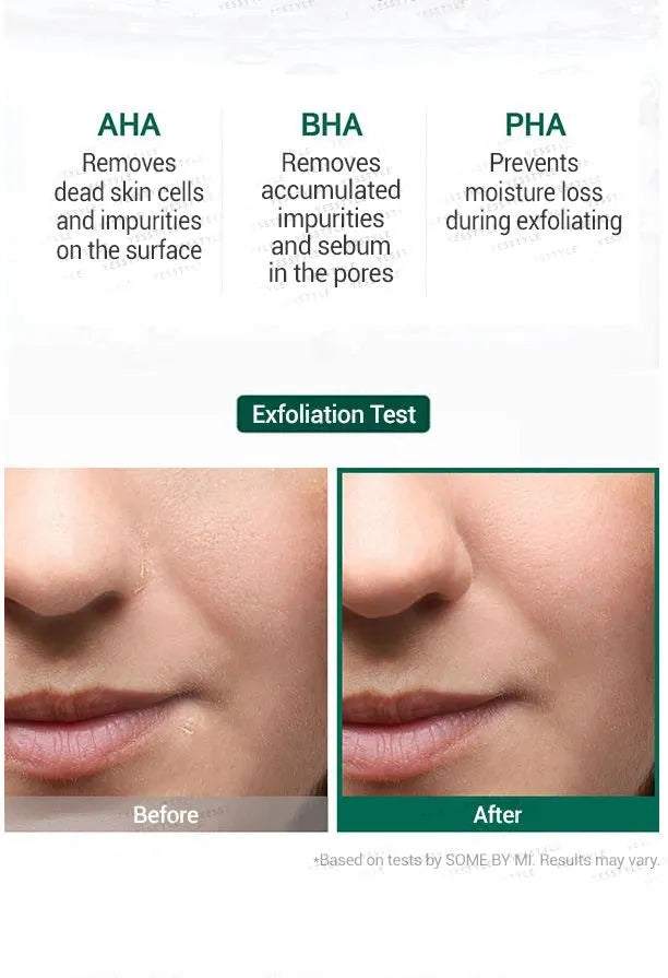 Some By Mi - AHA, BHA, PHA 30 Days Miracle Serum 50ml