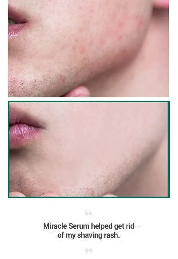 Some By Mi - AHA, BHA, PHA 30 Days Miracle Serum 50ml