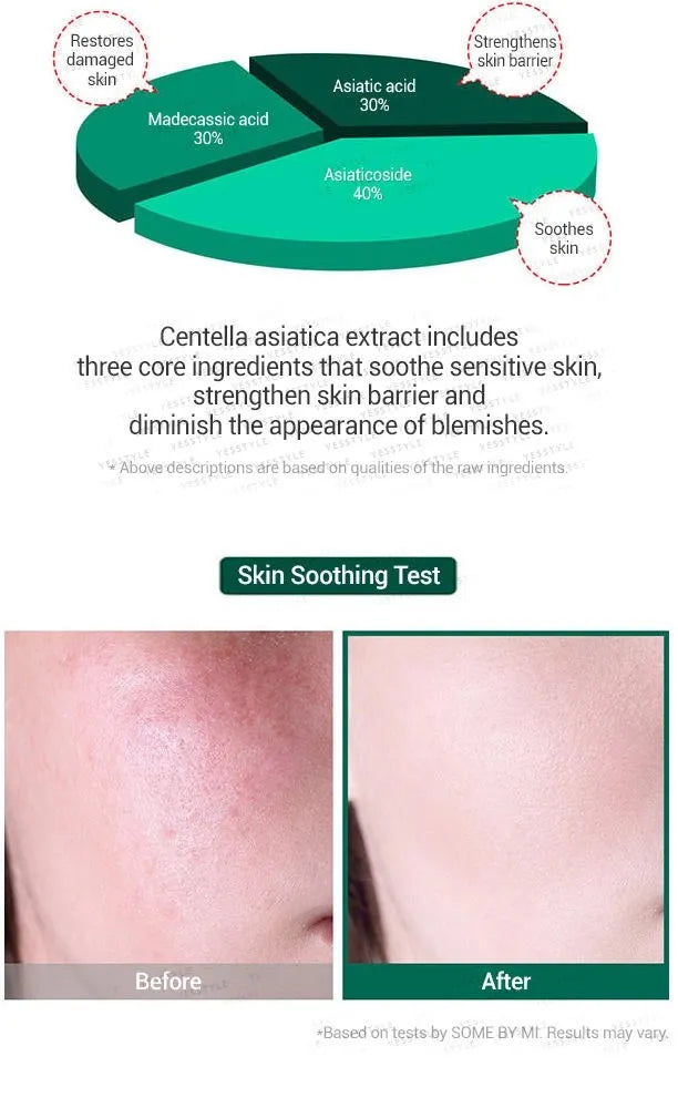 Some By Mi - AHA, BHA, PHA 30 Days Miracle Serum 50ml