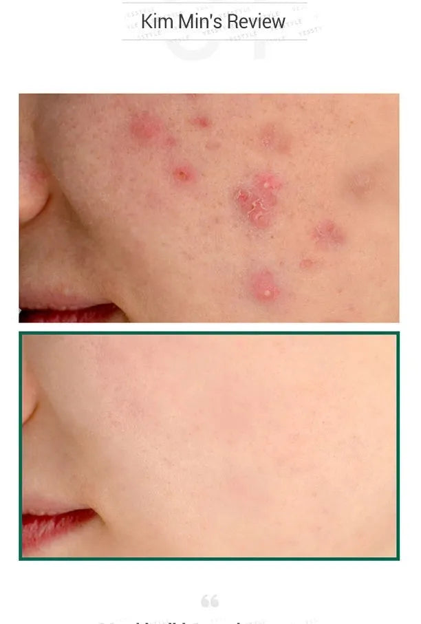 Some By Mi - AHA, BHA, PHA 30 Days Miracle Serum 50ml