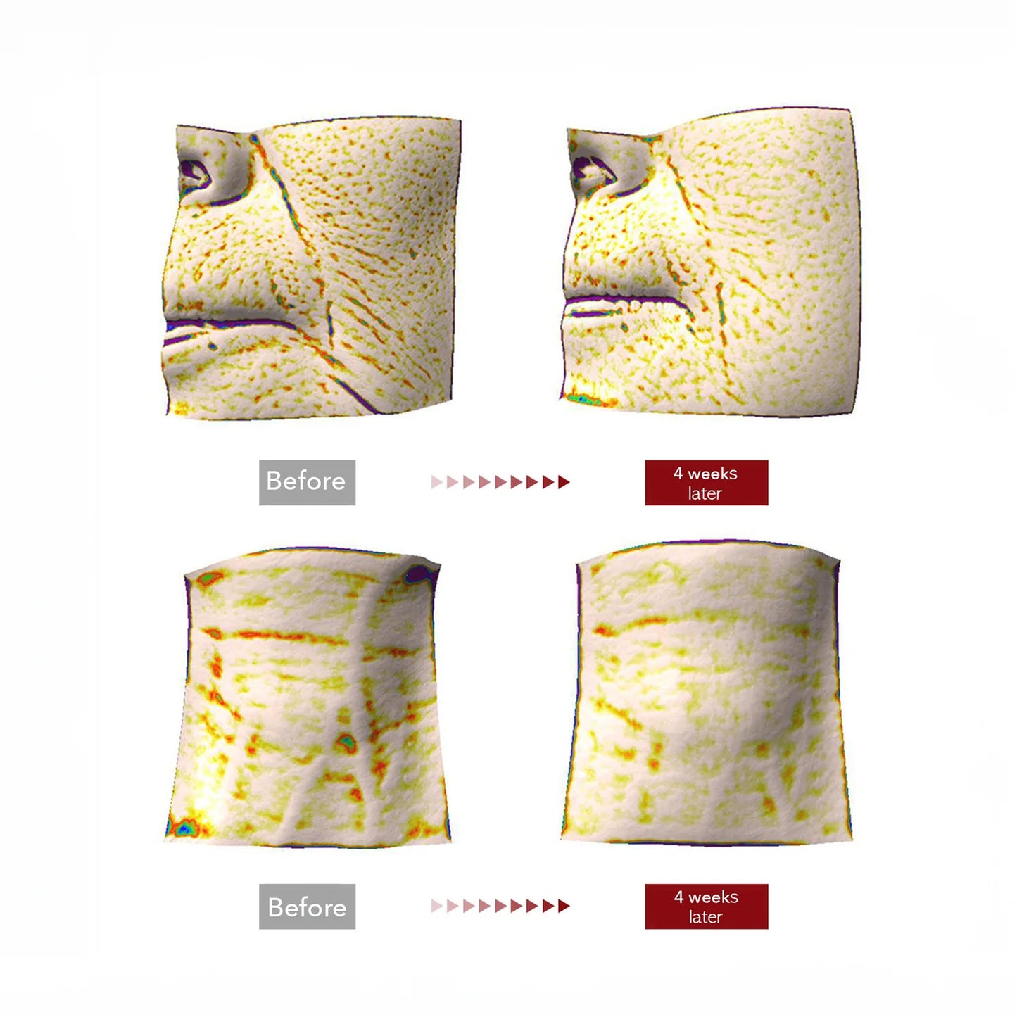 Centellian 24 – Madeca Cream Time Reverse (50 ml)